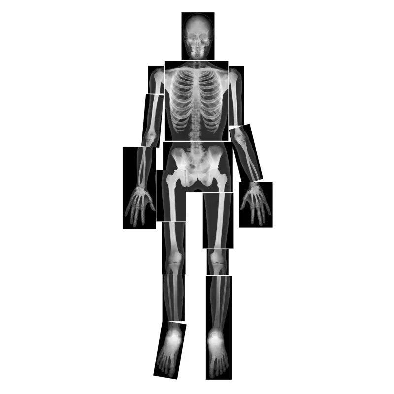 True to Life Human X-Ray Set, Pack of 18